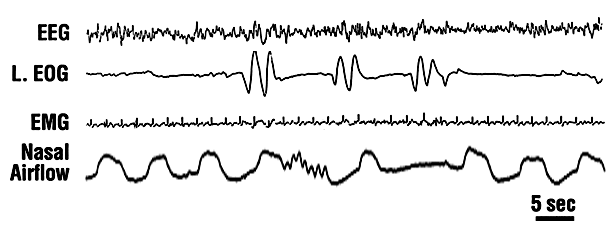 [Bild: laberge.fig3.gif]